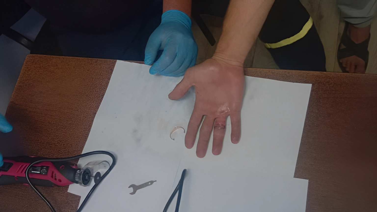 У Дубні бійці ДСНС рятували пальця місцевого жителя від затиснутого кільця У Дубні бійці ДСНС рятували пальця місцевого жителя від затиснутого кільця